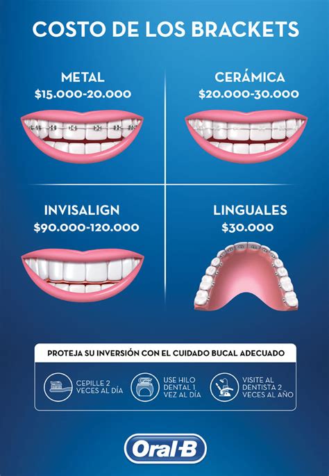 cuanto cuestan los brackets metalicos|cuanto cobran por poner brackets.